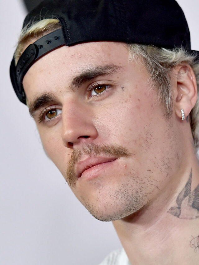 cropped-Justin-Biebers-face-paralyzed_1.jpg